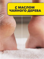 Крем для ног Шунгит Стоп грибок с маслом чайн дерева 100мл, y2050203029 y2050203029