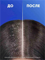 Head&Shoulders Шампунь от перхоти Ментол, 400 мл, y2020303303 y2020303303